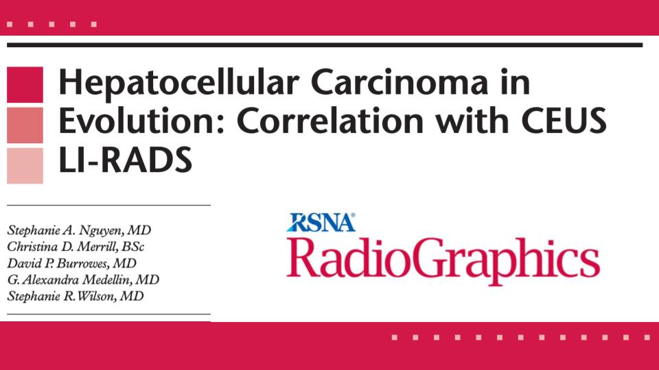 CameronAdlerMD's tweet photo. Hepatocellular carcinoma is the most common primary liver malignancy. Follow along as Dr. Nguyen, et. al., give us an image-guided tour through the evolution of HCC with contrast-enhanced ultrasound! 
#RGphx https://t.co/nP2wVRAeCS