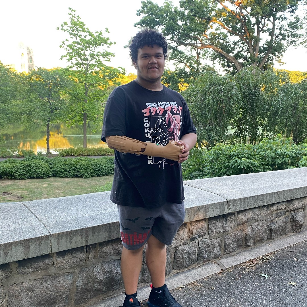 UnlimitedTmro's tweet photo. Welcome to the TrueLimb family Jayden!
#TrueLimb #bionicarm #prostheticarm #unlimitedtomorrow #myoelectricarm https://t.co/lukwyt93zD