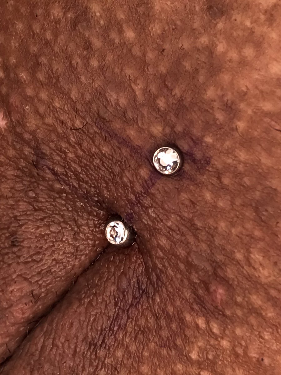 leeidipiercer's tweet photo. Perfuração íntima feminina https://t.co/NCQbprTxHY