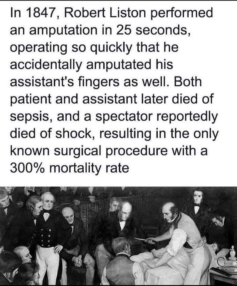 Hitos de la cirugía: Robert Liston puso el listón muy alto. 👇