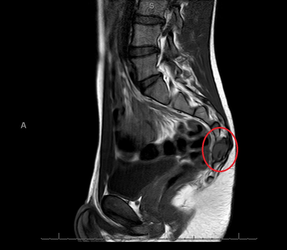 FabLab 3D Hospital Marañón tweet media