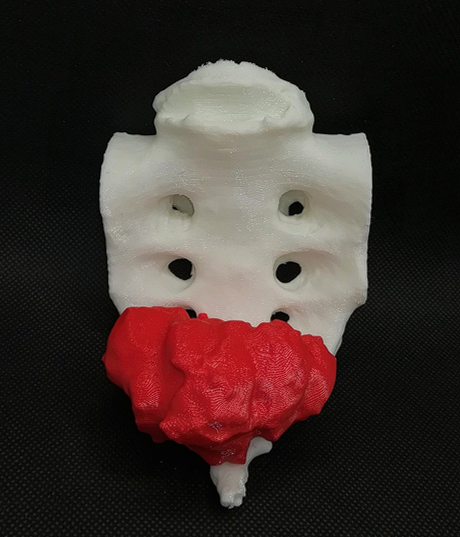 FabLab 3D Hospital Marañón tweet media