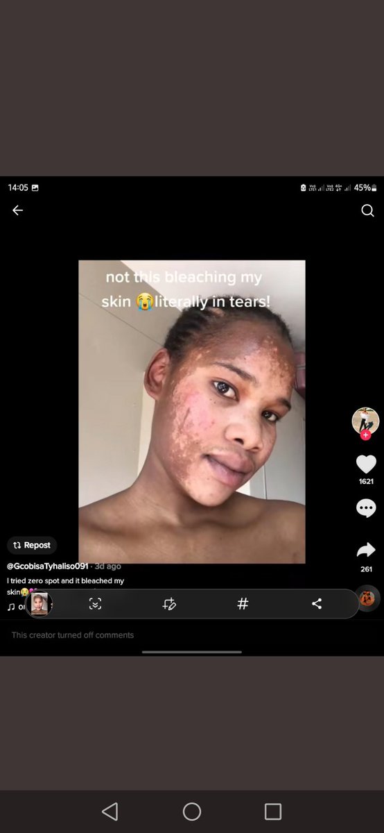 luyanda__MN's tweet photo. I hope she is compensated by this company that produced this horrible product 💔😭 #ZeroSpot https://t.co/7yejSb6JXg