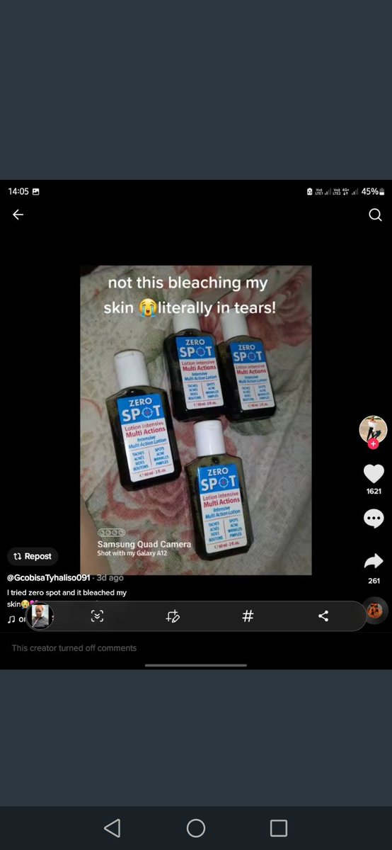 luyanda__MN's tweet photo. I hope she is compensated by this company that produced this horrible product 💔😭 #ZeroSpot https://t.co/7yejSb6JXg
