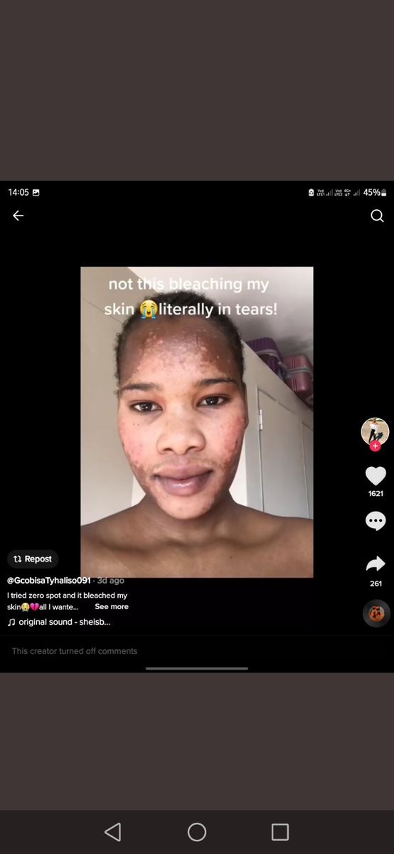 luyanda__MN's tweet photo. I hope she is compensated by this company that produced this horrible product 💔😭 #ZeroSpot https://t.co/7yejSb6JXg