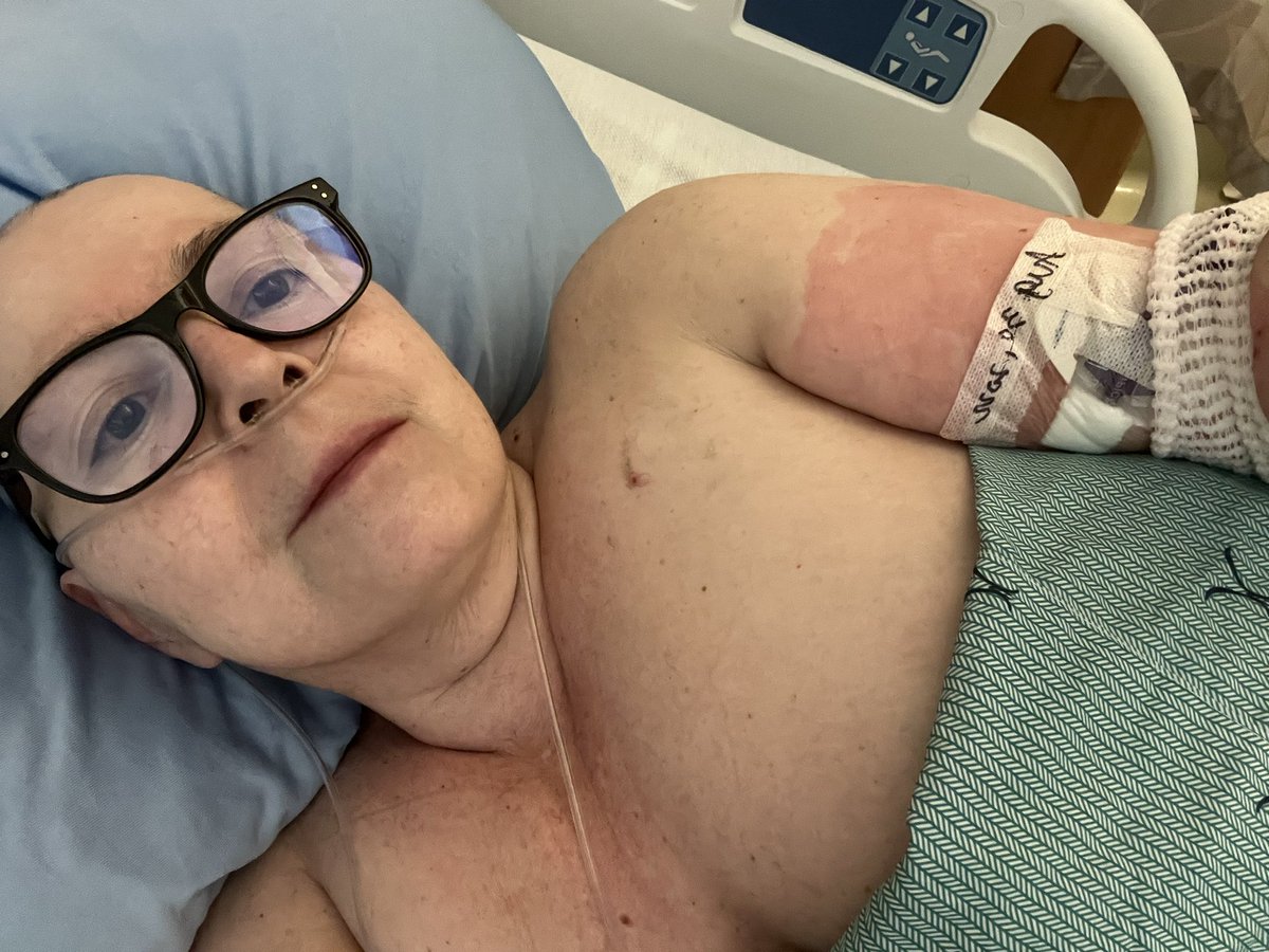 Risistrix's tweet photo. Still blocked by Twitter 😭My Tweeps still can’t see me to send love &amp; support. Begging to unblock me @TwitterSupport @Twitter
Pls retweet Twitter fam 💙
I had a small procedure to install my PICC Line yest.
Veins are shot from poking. No more! Now I have my PICC https://t.co/5NgvkDgHbG