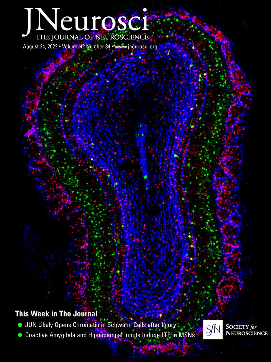 BunchOfChunk's tweet photo. Left-Right Locomotor Coordination in Human Neonates: Terrestrial locomotion requires coordinated bilateral activation of limb muscles, with left–right alternation in walking or running, and synchronous activation in hopping or skipping. The neural… https://t.co/9KBbiWDHdZ https://t.co/sbVcmyat5J