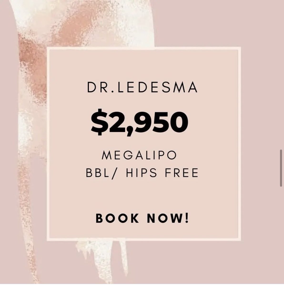 BodybyDoctor's tweet photo. Message us for more information!
#Lipo360 #plasticsurgery #MMO #results #BodyByDoctor #TheBestDoctors https://t.co/pMmTBxvbNF