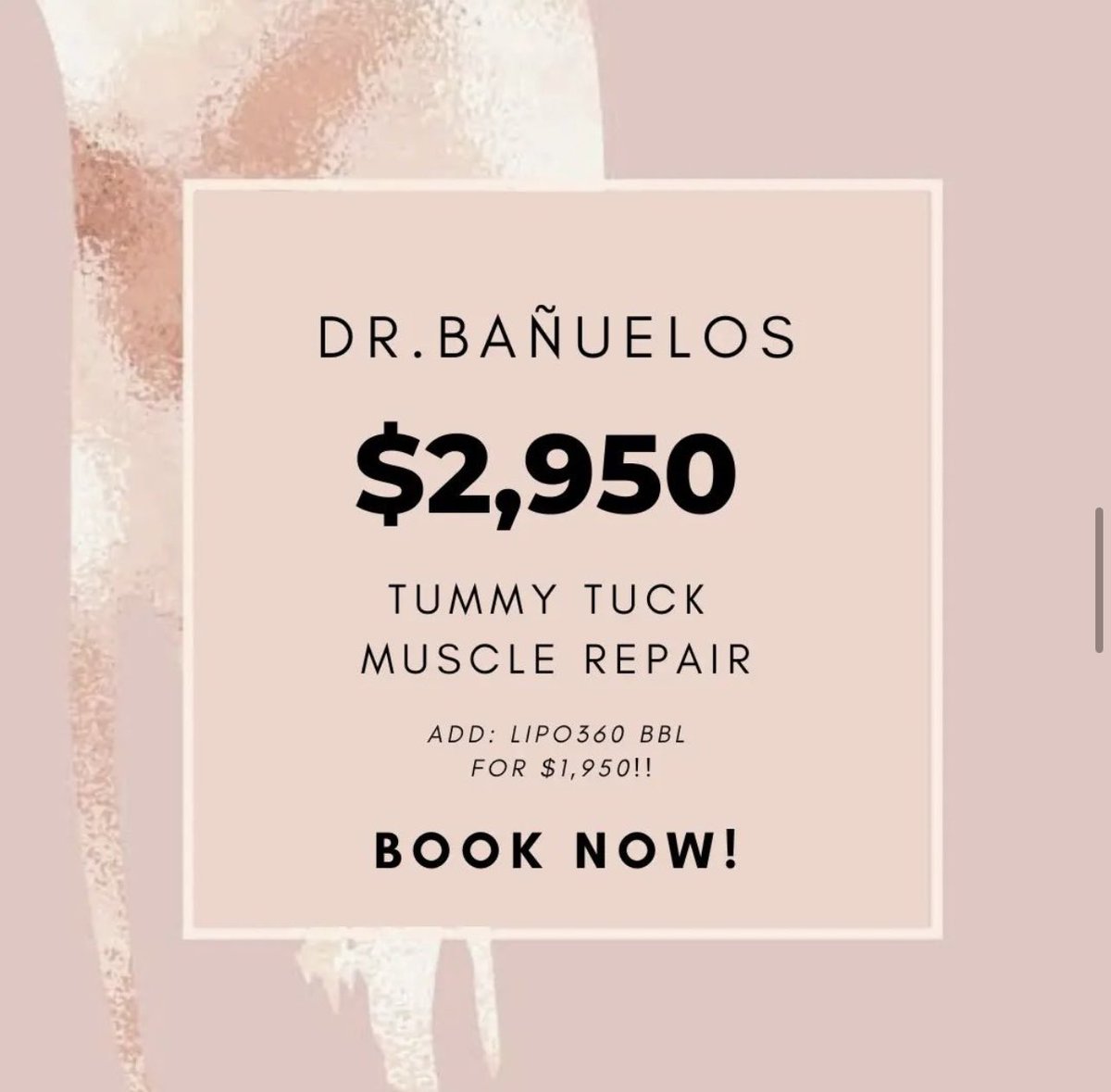 BodybyDoctor's tweet photo. Amazing Tummy for Dr. B! Don’t miss this amazing August promo! Message is for more information #BodyByDoctor #TummyTuck #MMO #Lipo360 #beforeandafter #Results #DrB #plasticsurgery https://t.co/ykI35UFAps