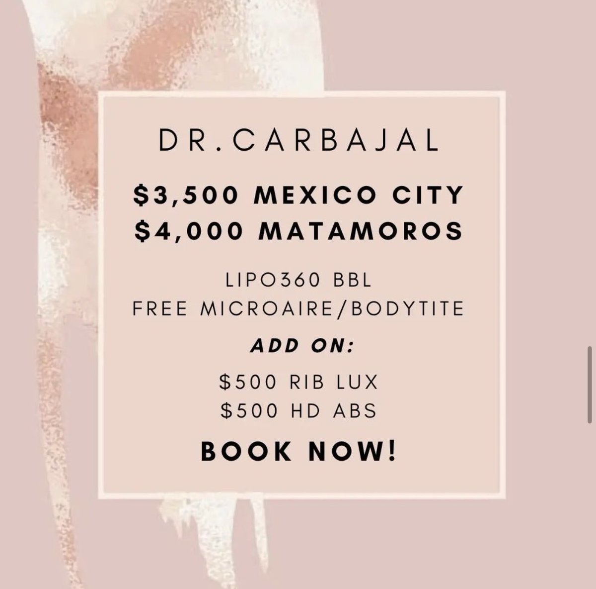 BodybyDoctor's tweet photo. Incredible HD Lipo! #BodyByDoctor #DrCarbajal #Abs #BBL #results #beforeandafter https://t.co/pdJ9ST327p