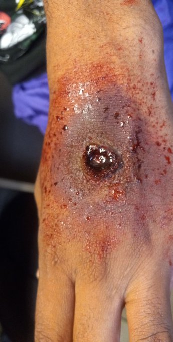 So I started doing #FXmakeup again mostly because I'm working up to a bigger project to get noticed by<a href="/tag/fxmakeup"class="tags">#FXmakeup</a><a href="/tag/goodmorning"class="tags"><span>#goodmorning</span></a><a href="/tag/netflix"class="tags"><span>#netflix</span></a><a href="/tag/artistontwitter"class="tags"><span>#artistontwitter</span></a><a href="/tag/param"class="tags"><span>#param</span></a>