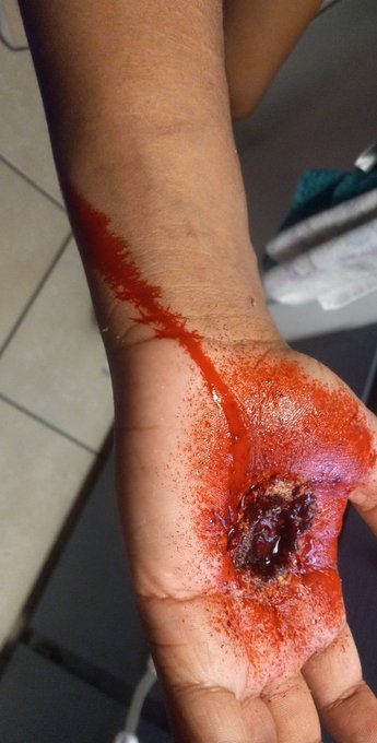 So I started doing #FXmakeup again mostly because I'm working up to a bigger project to get noticed by<a href="/tag/fxmakeup"class="tags">#FXmakeup</a><a href="/tag/goodmorning"class="tags"><span>#goodmorning</span></a><a href="/tag/netflix"class="tags"><span>#netflix</span></a><a href="/tag/artistontwitter"class="tags"><span>#artistontwitter</span></a><a href="/tag/param"class="tags"><span>#param</span></a>