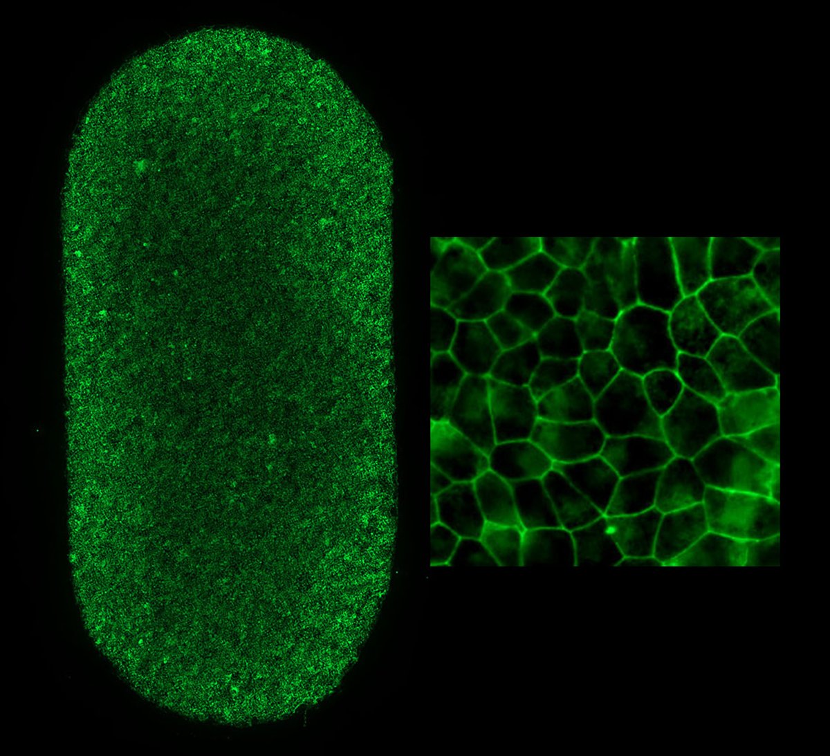 (1/2)
Clinical trial surgery at <a href="/NatEyeInstitute/">NEI</a> led by <a href="/Kapilbharti123/">Kapil Bharti</a>: #RPE patch developed from autologous #StemCells successfully implanted!
 
15 years' work: innovation in retinal biology, iPSCs, cell manufacturing, materials science, retinal surgery

bit.ly/3AIVduq