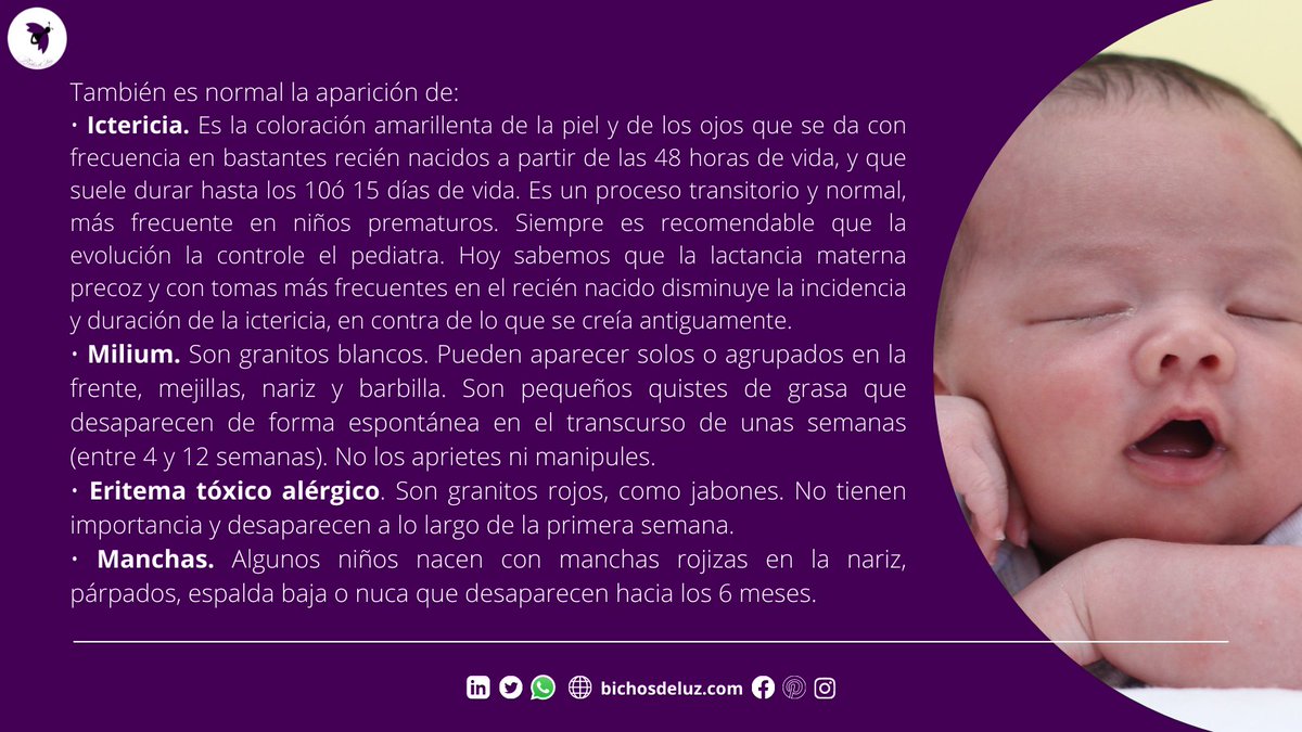 bichosdluz's tweet photo. La piel de mi bebé. 👶
Esos detalles que nos preocupan cuando es nuestro primer pequeñin y qué debemos saber.
Recuerda siempre consultar a tu pediatra.
#bichosdeluz #mama #baby #maternidad #amor #mamaprimeriza #maternity  #momlife #paternidad #crianza #pieldebebe #pielsensible https://t.co/Ck8ycinlbt