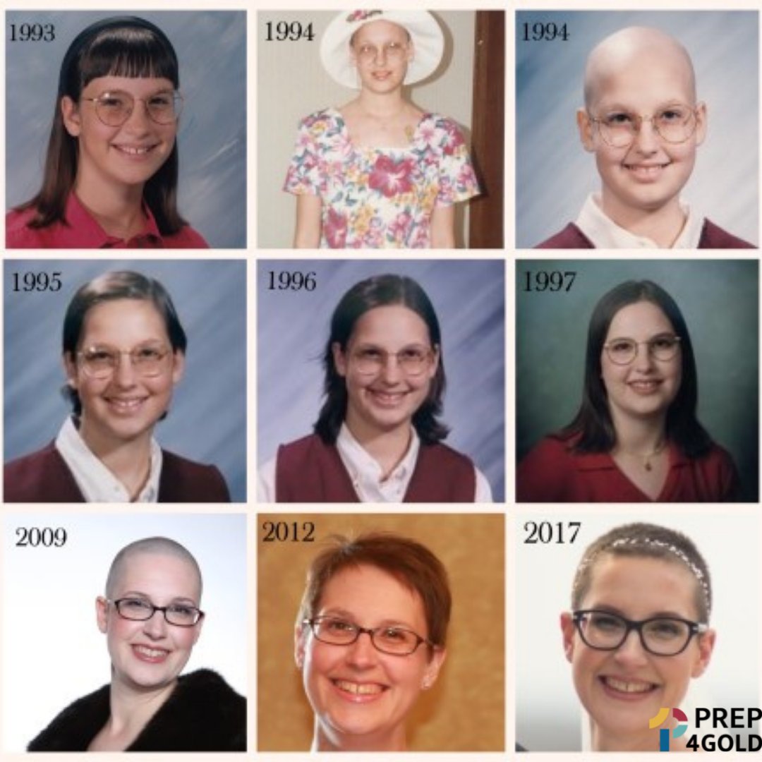 Because of cranial radiation treatment given to Carolyn, she has experienced basal cell carcinoma on her scalp. Carolyn continues to advocate for safer childhood cancer treatments through her work with Prep4Gold.  paypal.com/donate/?hosted…. #leukemia #childhoodcancer #cancer