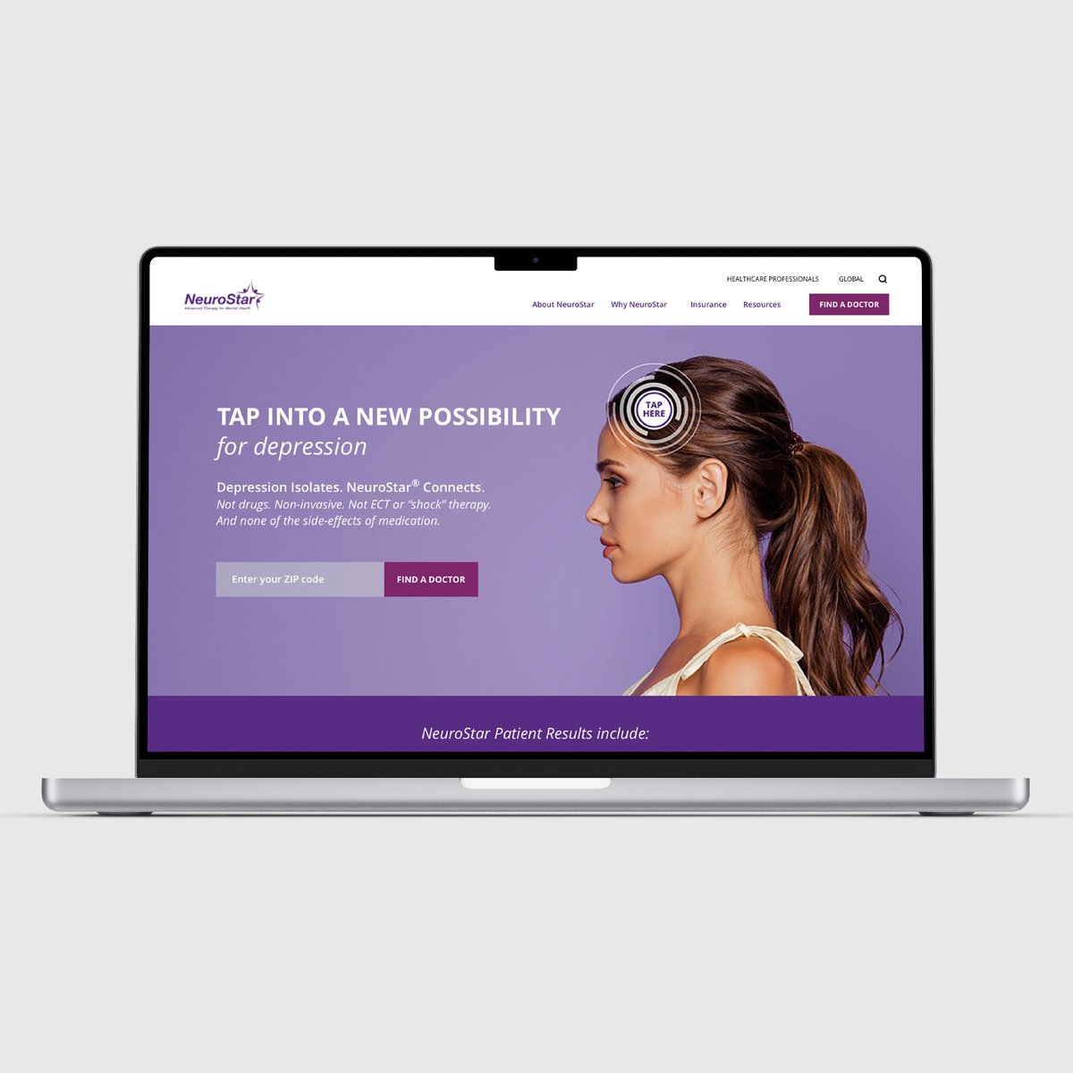 We partnered with NeuroStar for an awareness campaign for a ground-breaking depression therapy. Result - a powerful campaign that meets major depression sufferers where they are, and an opportunity to Tap Into A New Possibility for Depression. See case study results (111%+ Goal)