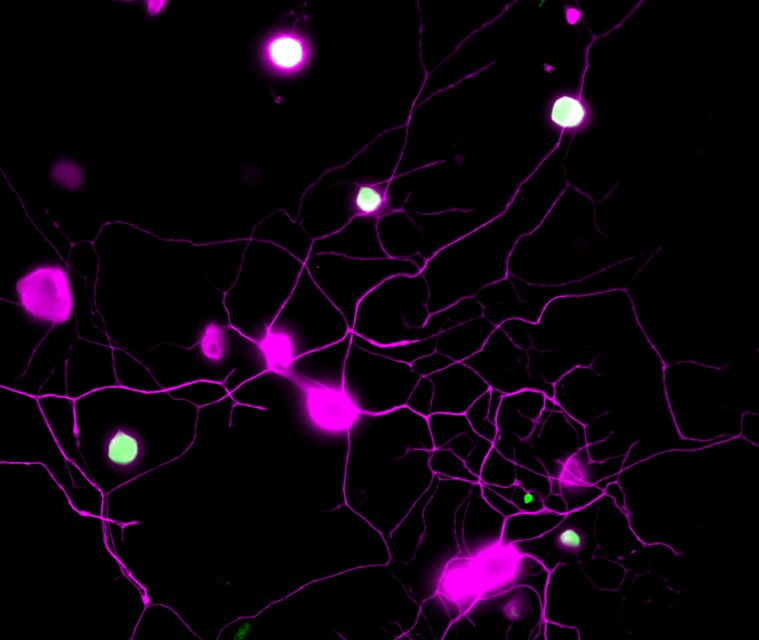 Pleased to share our @ScienceTM paper uncovering old drugs which target #BH4 (#tetrahydrobiopterin) metabolic pathway and explore their new roles in #chronicpain. > science.org/doi/full/10.11… 🧵/1