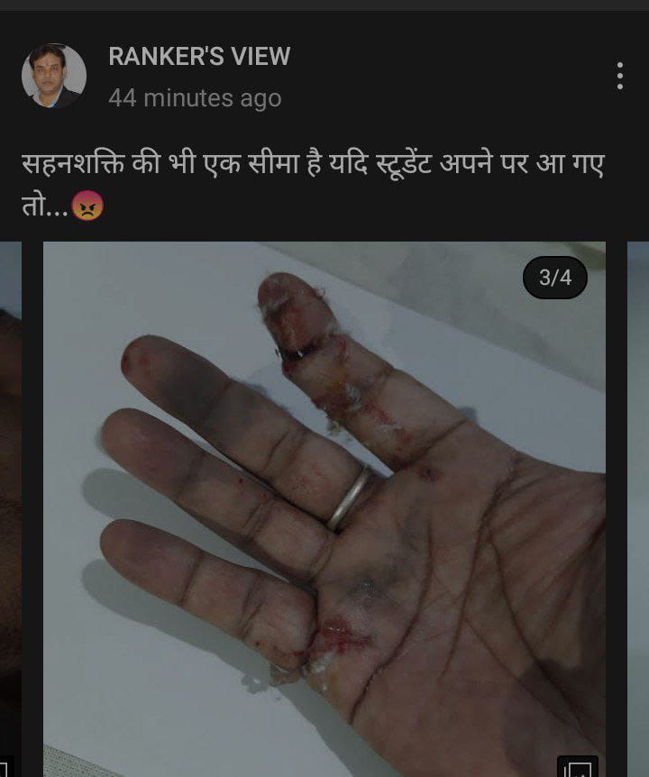 iPawanSwaraj's tweet photo. .
भला ऐसे कोन मार ता है भई ?
हैवानियत का हर सीमा पार कर दिया इस सीटीबाज प्रशासनों ने।

सवाल:- कहीं इन्होंने भी Setting से वर्दी तो नहीं पाया? 

ऐसे हालात मे बिहार में विकास कि नाव डगमगाते लहरों में कब तक तैरेगी ।
एक एक प्रहार याद रहेगा। 
😢😥😡😡🙏🙏🙏

#BPSC_PT_IN_ONE_SHIFT https://t.co/GSu60C7PFw
