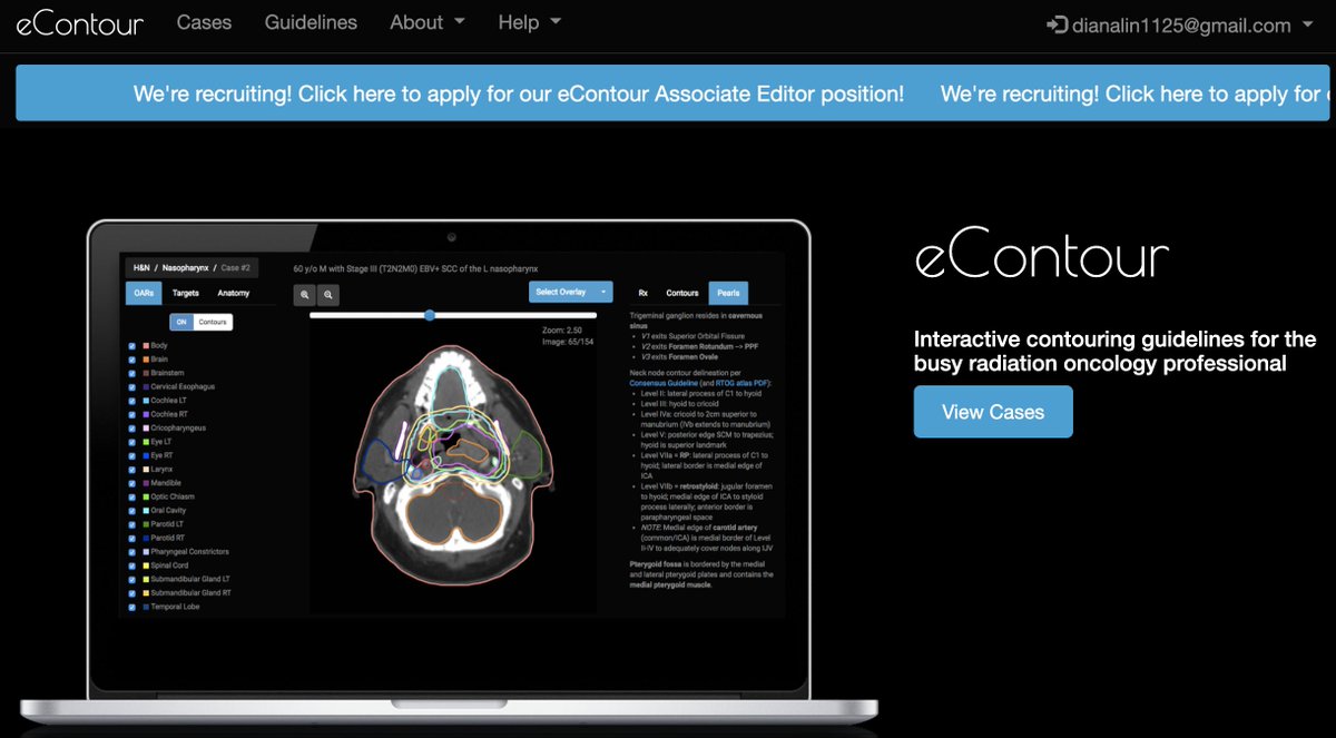 🚨 #eContour is recruiting! We're looking for a ⭐️ #radonc #resident to join our team as an Associate Editor. Apply here: docs.google.com/forms/d/e/1FAI…

Spread the word! We look forward to working with you! 😀

#meded <a href="/ACROresident/">ACROresident</a> <a href="/ASTRO_org/">ASTRO</a> <a href="/ARRO_org/">ARRO</a>