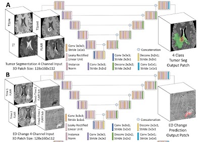 @UCSFimaging team trained 3D U-Net for longitudinal assessment of posttreatment diffuse glioma MRIs doi.org/10.1148/ryai.2… @RadRudie @DrDreMDPhD @NeuroDx #cancer #AI #MachineLearning