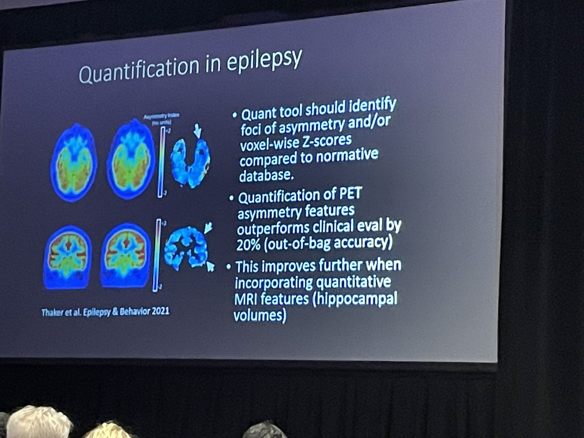 jodytanabe's tweet photo. Quantification in MRI-PET makes a difference! Great talk by @Asheshthaker #ASFNR22 @cuneurorad #qiba and MRPET session with @jana_ivanidze @anafranceschi #MRPET https://t.co/knvPUdS07i