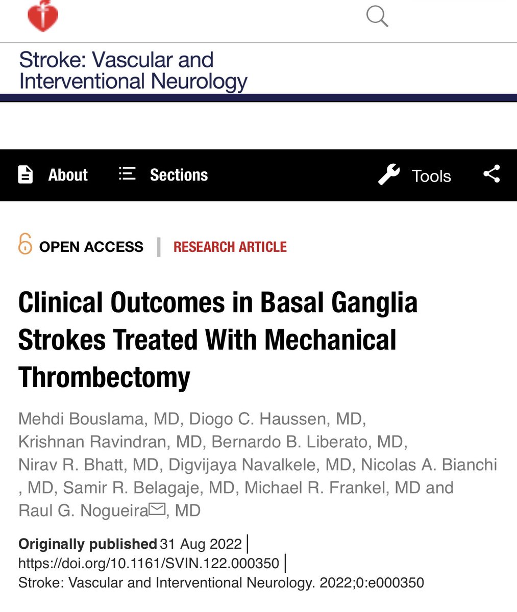 Total Basal Ganglia #strokes treated with #thrombectomy have higher risk of hemorrhagic conversion but similar functional outcomes as other infarct patterns. #nolvoleftbehind ⁦@RaulNogueiraMD⁩ @SVINJournal⁩ ⁦@svinsociety⁩ ⁦@SNISinfo⁩ ⁦@cvsection⁩ ⁦