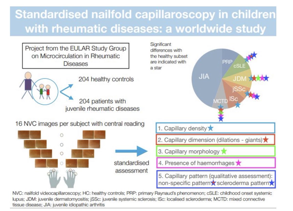 Delighted to have been a part of this 1st International collaboration defining #Capillaroscopy in #JuvenileRheumaticDiseases ! ✨Now Online✨ bit.ly/3q08MRe ⬇️Density: jSSc,JDM,MCTD,cSLE,lSc ⬆️Dilations:jSSc,MCTD,JDM ⬆️Abn shapes:JDM,MCTD ⬆️H’gges: jSSc,MCTD,JDM,cSLE