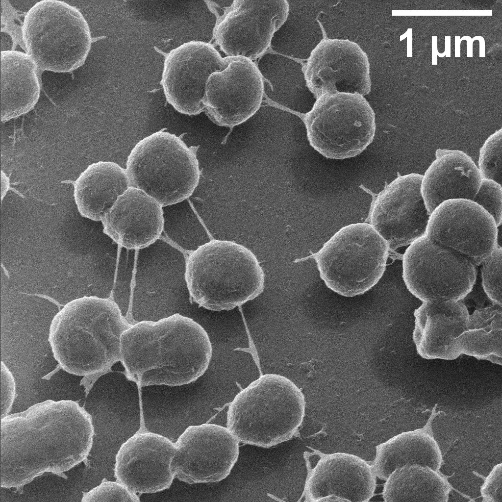 Congratulations to <a href="/wenyi_li68/">Wenyi Li</a> from the ACTV research group on winning the 2022 MCFP Image Competition with this image of MDR-A. baumannii colonizing a surface pre-biofilm using a Zeiss ORION NanoFab helium ion microscope at MCFP (eng.unimelb.edu.au/nanomaterials)