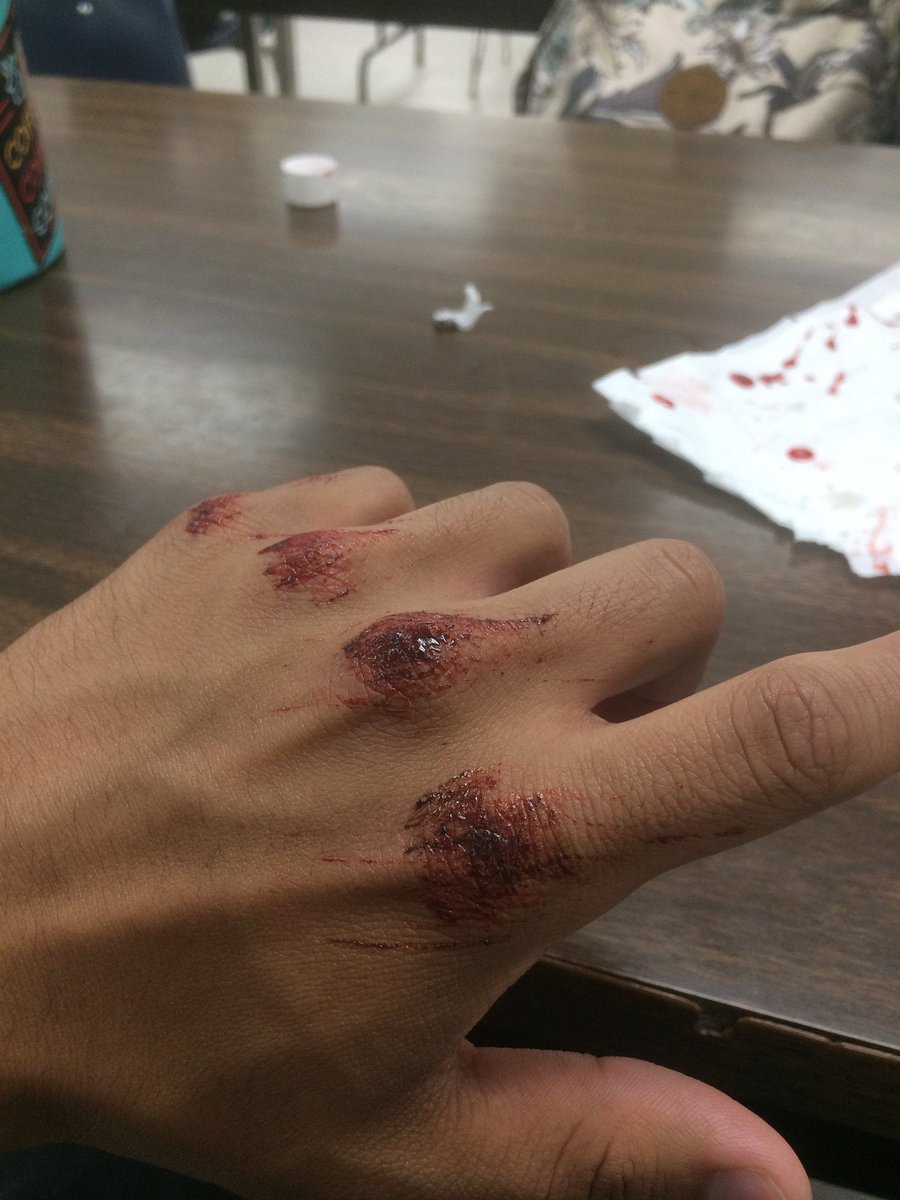 newslang333's tweet photo. Ketchup https://t.co/DZlaBa9nso