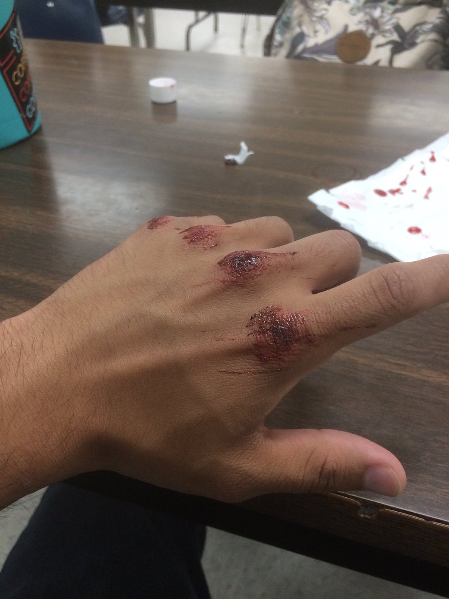 newslang333's tweet photo. Ketchup https://t.co/DZlaBa9nso