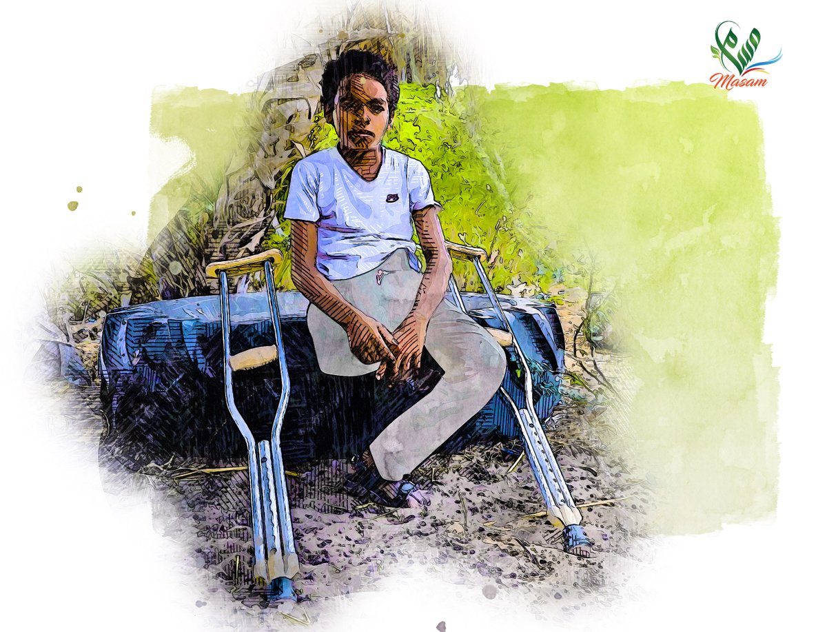 #صورة 

المشي بعكازات شقاء لا يتحمله جسد هذا الطفل، حيث يرمي جسده المنهك على اي جسم يعترضه في طريقه ليريحه من عبء خطوات معدودات

#مسام