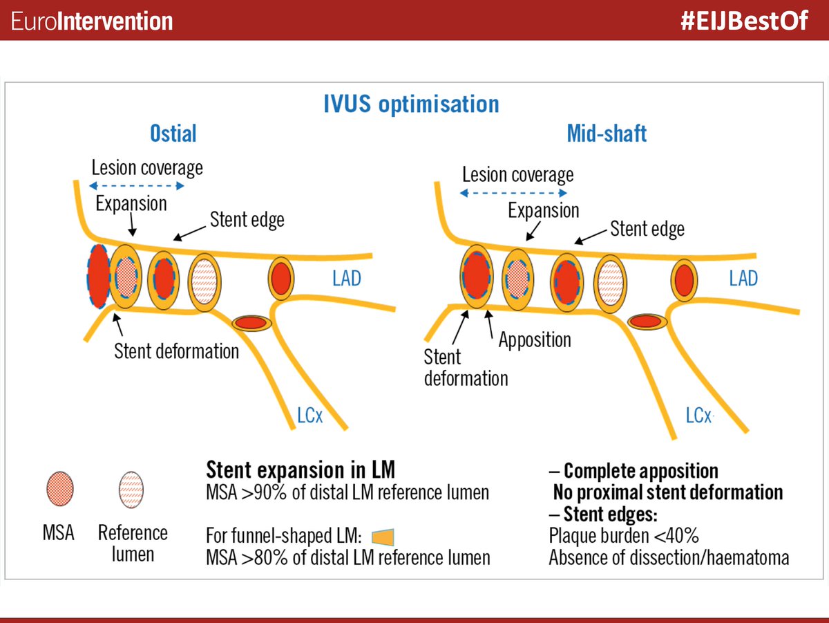 EuroInterventio's tweet photo. Interested in the use of intravascular ultrasound to guide PCI of the Left Main? Read more in our #EIJBestOf by Hernandez JM, et al. #IVUS #leftmainstenting https://t.co/C8l8otv01l https://t.co/qfquWusl0D
