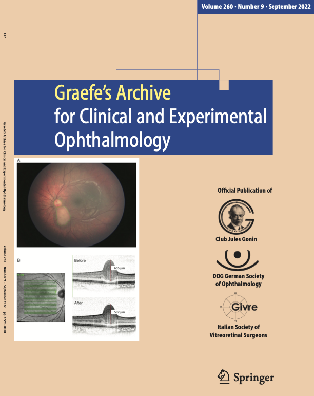 diepbiomed's tweet photo. September https://t.co/euJ9l7wa03 mTOR inhibitors safely reduce retinal astrocytic hamartoma in TSC patients @ClinMedJournals @Ophthalmologen @meyer_professor @oliverzeitz @AndrzejGrzybow @EdmundTsuiMD @SakamotoTaiji @KopicAndrijana @JiaHorungMD @KusuharaSentaro @SpringerSurgery https://t.co/EEA3Zi3n3Z