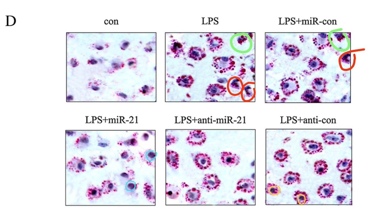 JJSanchezGil's tweet photo. @MicrobiomDigest Updated version with possibly duplicated nuclei. I think I found a new hobby? 😂 https://t.co/eRLZyjQxlk