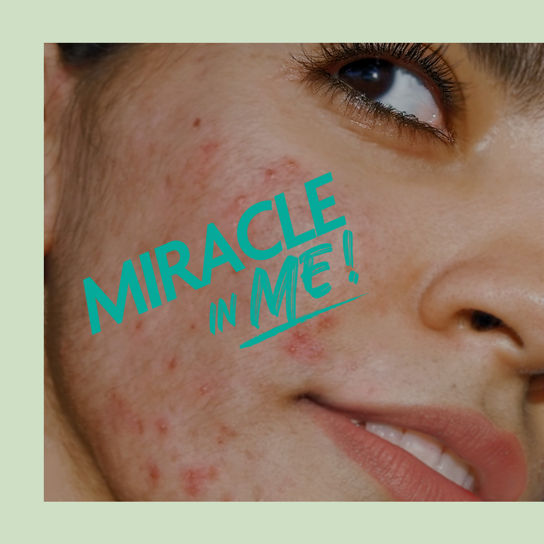 somebymi_jp's tweet photo. 人生でポジティブな変化をもたらしてくれる私の中の奇跡 #Miracle_In_Me ✨

ありのままの自分を受け入れ、どんな瞬間でも堂々といること
私の中の奇跡を信じてみてください。

MIRACLE IN ME
いつだってあなたが輝く姿で向き合えるようサムバイミーは応援しています。

SOME BY MI with YOU 💚 https://t.co/zgMLecUBiy