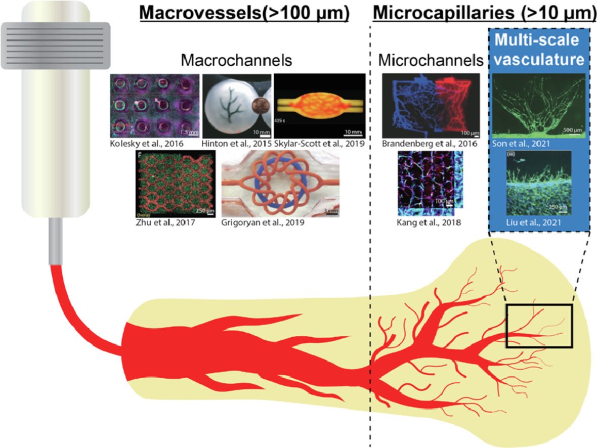 RicLevato's tweet photo. Vascularization of engineered tissues is still a main bottleneck for clinical translation. Leanne de Silva and @pau_bernal1 reviewed how #biofabrication #bioprinting can help: https://t.co/yRecspaxU7 nice collab led by @d_gawlitta @RMUtrecht @josmalda  @VET_UniUtrecht @UMCU_Intl https://t.co/9FPkW9waZT