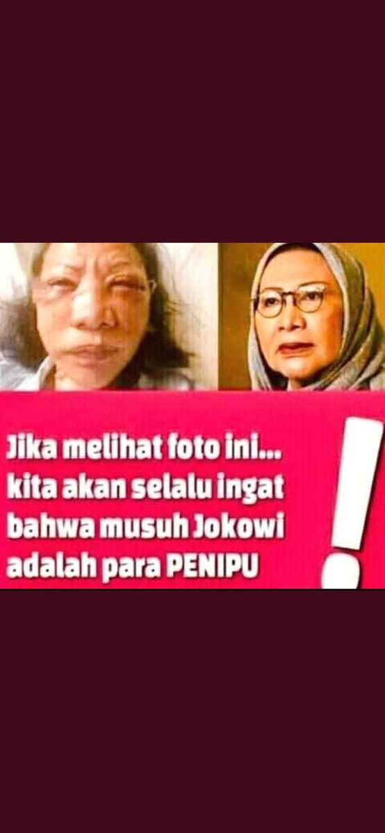 <a href="/Humaira922/">Humairah</a> <a href="/jokowi/">Joko Widodo</a> 😬😬