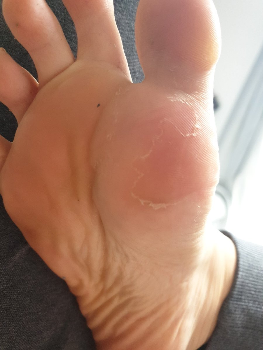 bowdownandserve's tweet photo. I think i need to give some attention to these today! May record it �� unless someone wants to fund a luxurious pedicure? £pandoraandherbox 

#feet #footfetish #findom #femdom #paypigs #finbrat https://t.co/HXtw7m7FUN