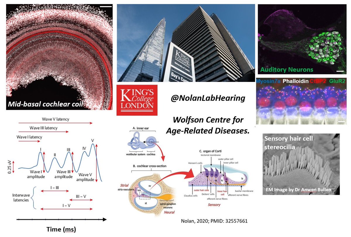 And here is the link to the 2nd #postdocposition I have open in #auditory #neuroscience 🔬👂🏻🧬 @WolfsonCARD - closing date 30th Sept. This one has both #developmental &amp; #ageing aspects. Would suit someone interested in #neurodevelopment #neurons #synapses