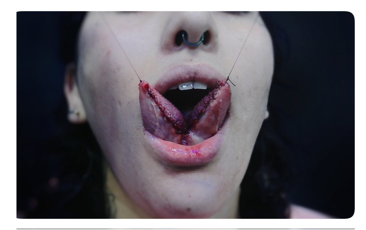 shoyu_irezumi's tweet image. 🐍𝕋𝕠𝕟𝕘𝕦𝕖 𝕤𝕡𝕝𝕚𝕥 𝕗𝕣𝕖𝕤𝕙👅
.
#tonguesplit fresh ⚡
-
Cotizá tu próximo proyecto mediante DM 
-
-
Visita mi perfil en @shoyu_irezumi.
-
-
#modificacioncorporal #piercer #astmf136 #tonguespliting #lenguabifida #piercings #titaniogradoimplante #shoyuirezumi #modified