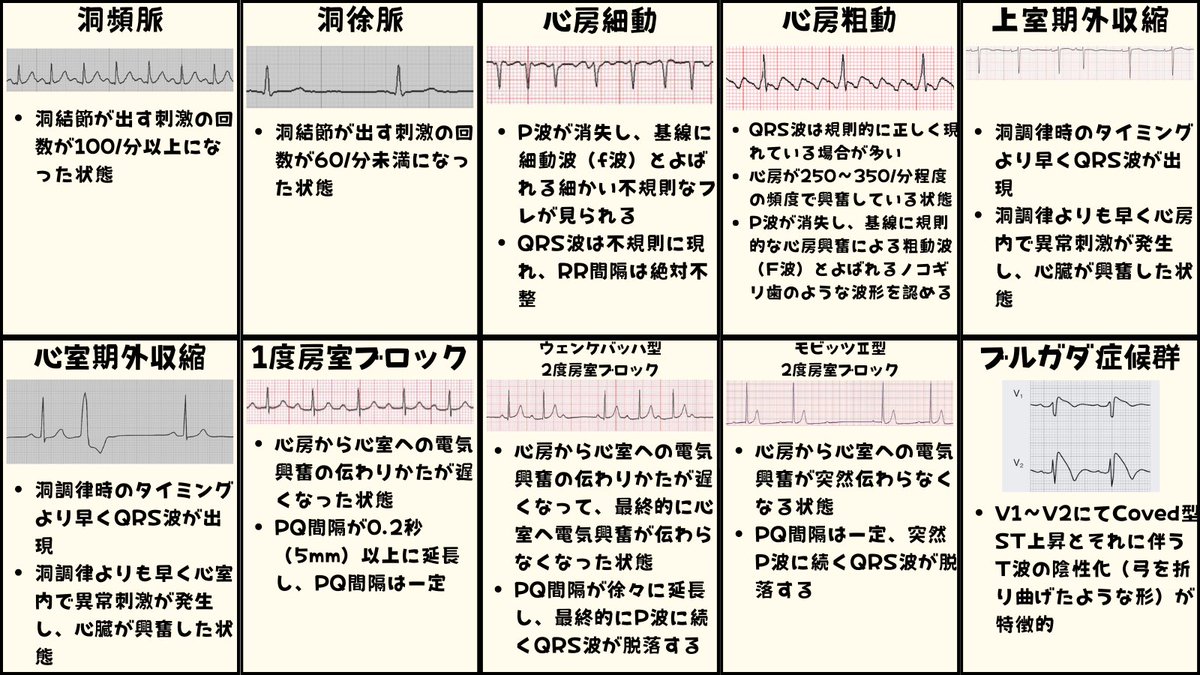 心電図くま | ECG KUMA tweet media