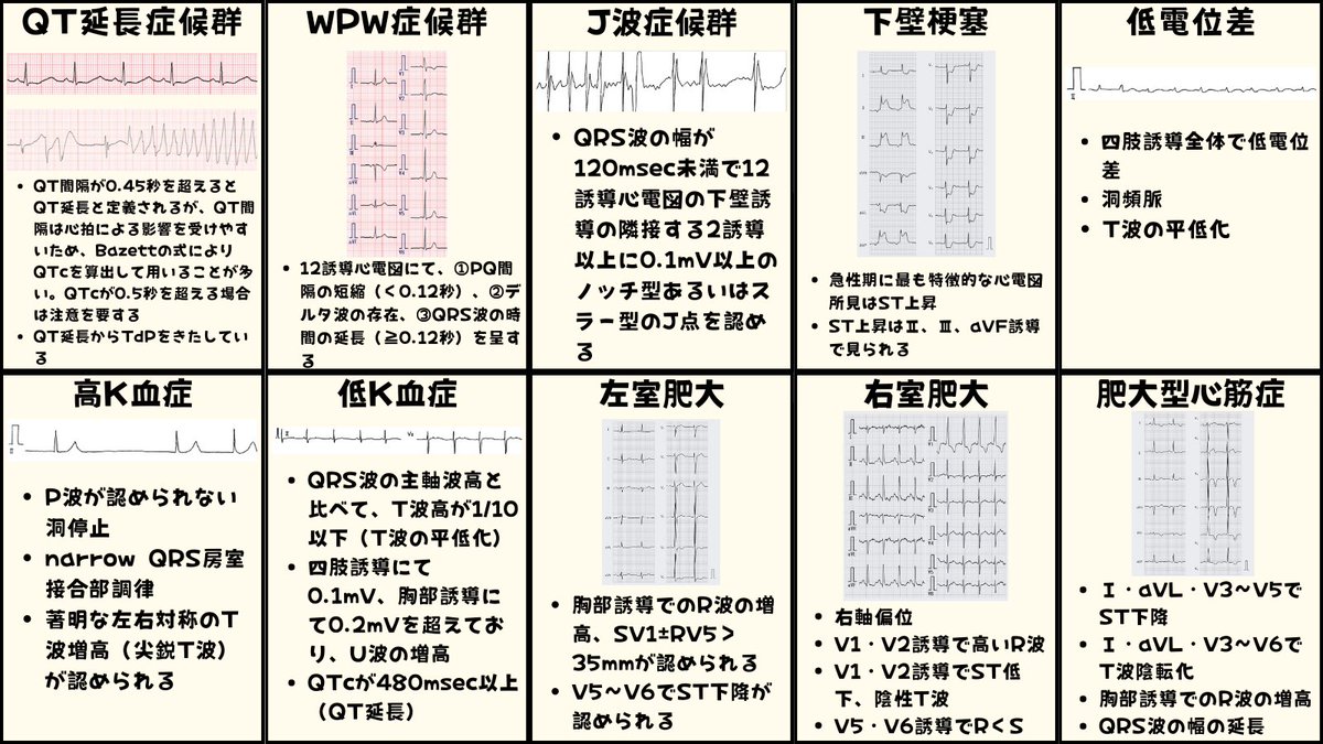 心電図くま | ECG KUMA tweet media