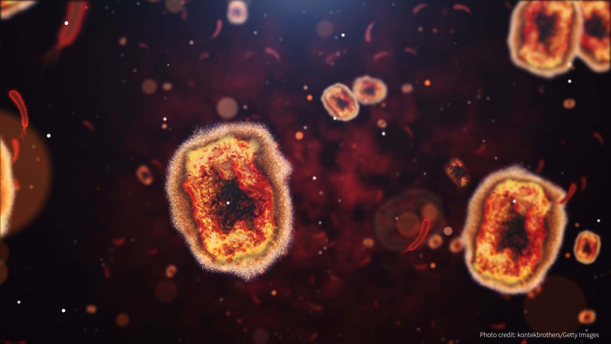 fhi360's tweet photo. The recent surge in reported cases of #monkeypox has caused @WHO to declare the virus a #publichealth emergency.
Join us for @EpiCproj's “Monkeypox: An Update on the Current Epidemic and Implications for #HIVPrograms”.
🗓️ Sep 7
⏰ 8:00 AM ET
https://t.co/OQ5iVLCLaD https://t.co/AUK1xrQD0a
