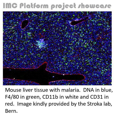 Our next IMC Platform project showcase is on display!  Thanks to <a href="/DanaLeuenb/">Dana</a>, <a href="/VSRL_Bern/">Visceral Surgery Research Bern</a>, <a href="/unibern/">Universität Bern</a> and  the Stroka lab.