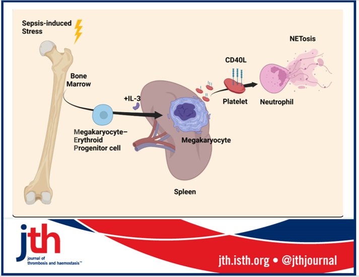 JTHjournal's tweet photo. New NEIGHBORHOOD WATCH: In spirit of promoting EDI principles – Let’s embrace megakaryocyte and #platelets diversity in sepsis. @boilard_eric @FPuhm https://t.co/x6VCdetcjy For @jclinicalinvest paper: https://t.co/YG2HNXfoZl https://t.co/ayvAvud77Y