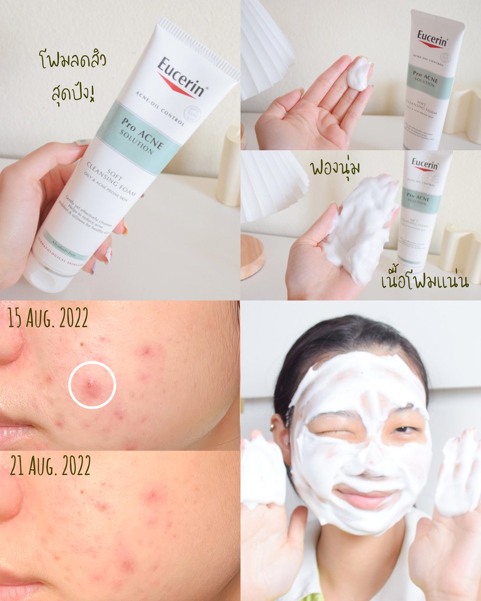โฟมล้างหน้าลดสิวยูเซอรินตัวนี้คือดีมาก!! 🧼อันนี้คือหลอดที่สองแล้วนะ ใช้แล้วสิวอักเสบแห้งไว สิวอุดตันลดลง มันดือออออจริง 💖 ช่วงไหนสิวเยอะๆคือต้องหยิบมาใช้เลย สิวยุบไว รอยจางลง หน้าดีขึ้นมาก #ไว้รีวิวห้ามขายของโว้ยย #ใช้จริงรีวิวจริง