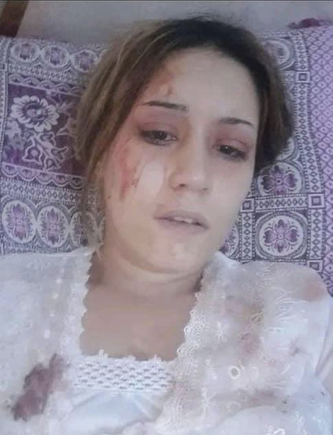 AfghanCouncilGB's tweet photo. Torture, rape &amp; terror inflicted on women by officials within Taliban are the worst humanity has experienced in the 21st century.

If this doesn't awaken British courage @10DowningStreet, @FCDOGovUK &amp; @ukhomeoffice to offer special protection to Afghan women, then nothing will. https://t.co/QYXob6kdpt