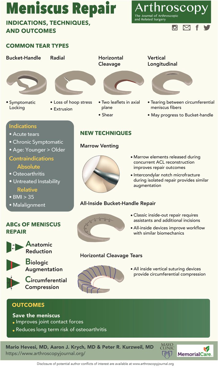 NuelleSportsMD's tweet photo. Infographic week! Meniscus tear types and repair indications. #orthotwitter https://t.co/OU9Zf2CZjE