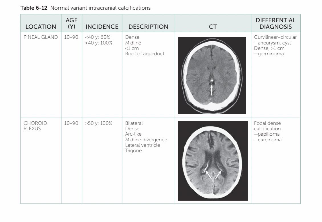 Medical_MD1's tweet image. Brain CT scan ✨
Great differentiation between 
Normal vs Abnormal signs 👌🏼🤩
.