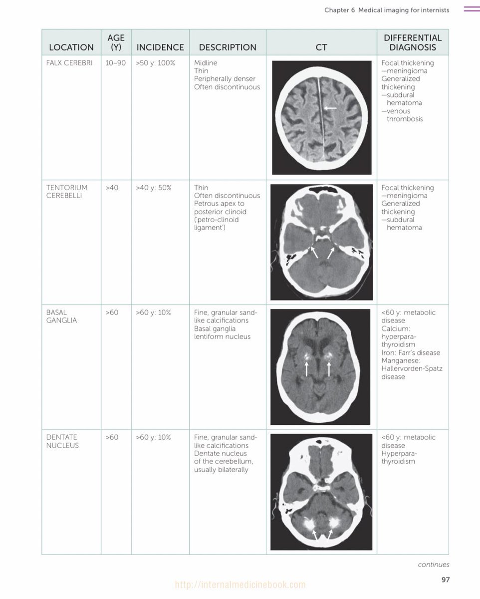 Medical_MD1's tweet image. Brain CT scan ✨
Great differentiation between 
Normal vs Abnormal signs 👌🏼🤩
.